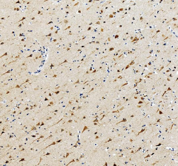 PNPLA6 Antibody for IHC. Immunohistochemistry analysis in human brain tissue. FFPE human brain tissue stained with PNPLA6 antibody shows cytoplasmic staining in neuronal cell bodies and processes, consistent with its role in phospholipid metabolism and neuronal maintenance. Detection was performed using an HRP-conjugated secondary antibody with DAB chromogen (brown), and nuclei are counterstained with hematoxylin (blue). Antigen retrieval was carried out using pH8 EDTA buffer with heat-induced epitope retrieval prior to staining.