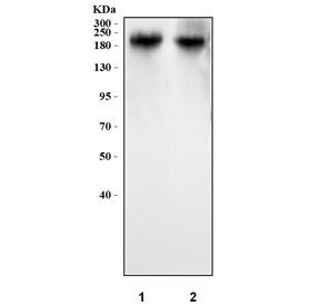 Western blot testing of human 1) MCF7 and 2) HaCaT cell lysate with Carcinoembryonic Antigen antibody. Expected molecular weight: 80~200 kDa depending on glycosylation level.