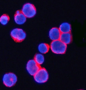 CD3 Gamma Antibody Human JK Cell IF. Immunofluorescent staining of FFPE human JK cells with CD3 gamma antibody (red). Heat-induced epitope retrieval (HIER) was performed by steaming sections in pH 6 citrate buffer for 20 minutes prior to staining. Nuclei are counterstained with DAPI (blue). CD3 gamma immunoreactivity is observed predominantly along the cell membrane, consistent with the expected localization of this T-cell receptor complex protein involved in antigen recognition and T-cell activation.