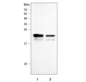CD3 Gamma Antibody Human T-Cell WB. Western blot testing of 1) human MOLT4 and 2) human Jurkat cell lysates with CD3 gamma antibody. A single band is detected at approximately 21 kDa in both T-cell lysates, consistent with the predicted molecular weight of CD3 gamma. The results demonstrate specific detection of this T-cell receptor complex protein, which plays an essential role in antigen recognition and T-cell activation.