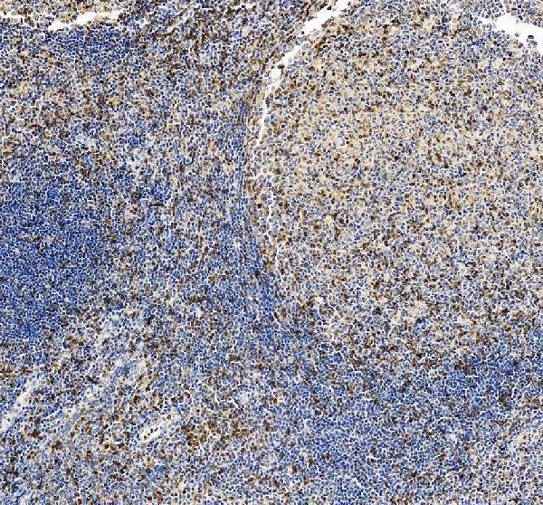 CD3 Gamma Antibody Human Tonsil IHC. Immunohistochemical staining of FFPE human tonsil tissue with CD3 gamma antibody at 2 ug/ml. Heat-induced epitope retrieval (HIER) was performed by boiling tissue sections in pH 8 EDTA buffer prior to staining. CD3 gamma immunoreactivity is observed predominantly along the cell membranes and within the cytoplasm of lymphocytes, consistent with the expected localization of this T-cell receptor complex protein involved in antigen recognition and T-cell activation. Cell nuclei are counterstained with hematoxylin (blue).
