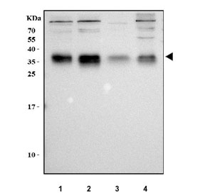 Western blot testing of human 1) 293T, 2) RT4, 3) ThP-1 and 4) A549 cell lysate with TM2D3 antibody. Predicted molecular weight ~27 kDa but may be observed at higher molecular weights due to glycosylation.