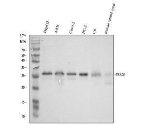 PRRG1 Antibody by WB in human cell lines, rat C6 cells and mouse spinal cord. Western blot analysis of PRRG1 using rabbit polyclonal antibody. Samples were separated by 12% SDS-PAGE under reducing conditions, with 30 ug of protein loaded per lane. Lane 1: human HepG2 cells; lane 2: human A431 cells; lane 3: human Caco-2 cells; lane 4: human PC-3 cells; lane 5: rat C6 cells; lane 6: mouse spinal cord. A prominent band is detected at approximately 28-30 kDa in the human samples, with weaker signals in rat and mouse samples. The predicted molecular weight is approximately 25 kDa. The modest upward migration may reflect post-translational modifications or electrophoretic behavior of this membrane-associated protein. This TMG1 Polyclonal Antibody was used at 0.5 ug/ml.