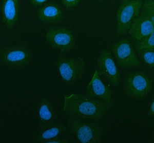 PRRG1 Antibody by IF in human SiHa cells. Immunofluorescence staining of human SiHa cells using PRRG1 Antibody at 5 ug/ml. Green fluorescence indicates PRRG1 immunoreactivity, while DAPI counterstaining identifies nuclei in blue. The image shows relatively weak, diffuse green staining in the extranuclear cellular regions, with occasional brighter peripheral and punctate signals. Nuclear regions exhibit little green fluorescence. The distribution is compatible with an extranuclear protein, although a distinct plasma membrane localization cannot be established from this image alone. Cells underwent enzymatic antigen retrieval and overnight primary antibody incubation at 4oC, followed by a Fluoro488-conjugated secondary antibody. This TMG1 Polyclonal Antibody provides an additional means of examining PRRG1 localization.