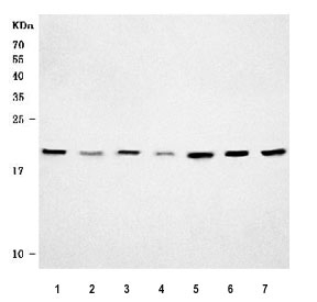Western blot testing of 1) human HeLa, 2) human Jurkat, 3) human A431, 4) human 293T, 5) rat brain, 6) rat C6 and 7) mouse brain tissue lysate with CDC42 antibody. Predicted molecular weight ~21 kDa.