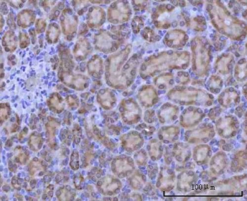 IHC staining of FFPE rat kidney tissue with Renin antibody. HIER: boil tissue sections in pH8 EDTA for 20 min and allow to cool before testing.