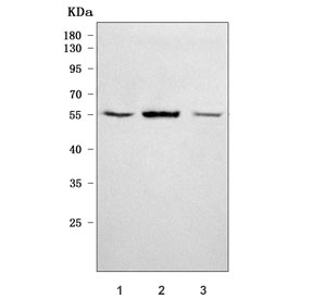Western blot testing of human 1) 293T, 2) HepG2 and 3) HUH-7 cell lysate with Renin antibody. Predicted molecular weight ~45 kDa but may be observed at higher molecular weights due to glycosylation.