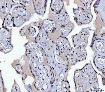IHC staining of FFPE human placental tissue with B-cell lymphoma/leukemia 11B antibody. HIER: boil tissue sections in pH8 EDTA for 20 min and allow to cool before testing.