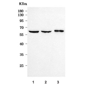 Western blot testing of human 1) PC-3, 2) SiHa and 3) A431 cell lysate with PPP2R5B antibody. Predicted molecular weight ~57 kDa.