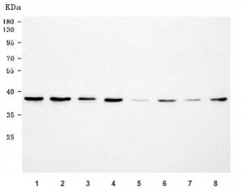 Western blot testing of 1) human HepG2, 2) human A549, 3) human HeLa, 4) human 293T, 5) rat brain, 6) rat RH35, 7) mouse brain and 8) mouse Neuro-2a cell lysate with HRMT1L2 antibody. Predicted molecular weight: 40-42 kDa (multiple isoforms).
