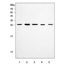 Western blot testing of 1) human HeLa, 2) human 293T, 3) human Jurkat, 4) rat brain and 5) mouse brain tissue lysate with HGPRTase antibody. Predicted molecular weight ~24 kDa.