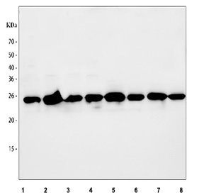 Western blot testing of 1) human HeLa, 2) human 293T, 3) human A549, 4) human MCF7, 5) rat brain, 6) rat C6, 7) mouse brain and 8) mouse NIH 3T3 cell lysate with HGPRTase antibody. Predicted molecular weight ~24 kDa.