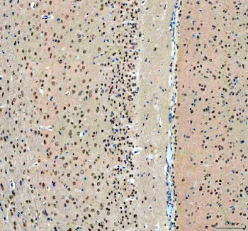 IHC staining of FFPE rat brain tissue with OTT1 antibody, HRP-secondary and DAB substrate. HIER: boil tissue sections in pH8 EDTA for 20 min and allow to cool before testing.
