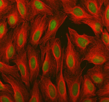 Immunofluorescent staining of FFPE human U-2 OS cells with OTT1 antibody (green) and Alpha Tubulin mAb (red). HIER: steam section in pH6 citrate buffer for 20 min.