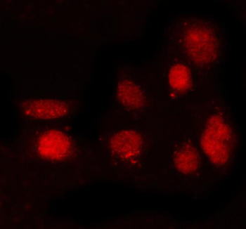Immunofluorescent staining of FFPE human PC-3 cells with PRDM8 antibody (red). HIER: steam section in pH6 citrate buffer for 20 min.