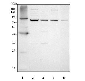 Western blot analysis using PRDM8 antibody. Lane 1: human HT1080 whole cell lysates; Lane 2: human MCF-7 whole cell lysates; Lane 3: human SH-SY5Y whole cell lysates; Lane 4: rat brain tissue lysates; Lane 5: mouse brain tissue lysates. The predicted molecular weight of PRDM8 is ~72 kDa, and a band is observed at the expected size. In HT1080 cells, PRDM8 migrates slightly higher, consistent with cell-type-dependent modification or isoform variation.