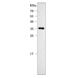 Western blot testing of human Caco-2 cell lysate with Apolipoprotein E antibody. Predicted molecular weight: 34-37 kDa.
