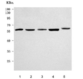 Western blot testing of 1) human HepG2, 2) human HeLa, 3) human U-87 MG, 4) human 293T and 5) rat RH35 cell lysate with NAB1 antibody. Predicted molecular weight ~54 kDa.