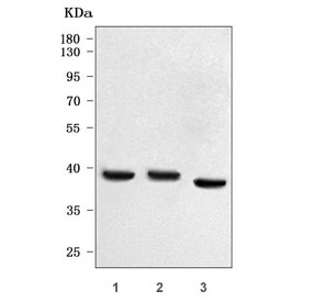 Western blot testing of human 1) Caco-2, 2) MCF7 and 3) placental tissue lysate with Prostasin antibody. Predicted molecular weight ~36 kDa.