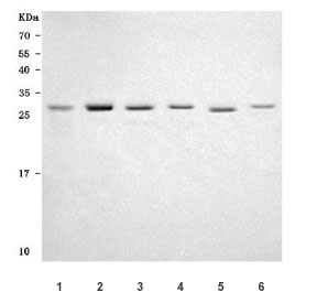 Western blot testing of 1) human Caco-2, 2) human HeLa, 3) human A549, 4) human K562, 5) rat brain and 6) mouse brain tissue lysate with PRTFDC1 antibody. Predicted molecular weight ~26 kDa, ~22 kDa, ~20 kDa (three isoforms).