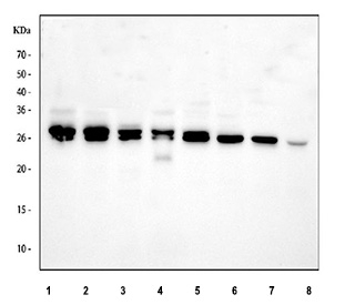 Western blot testing of 1) human Caco-2, 2) human HEL, 3) human A549, 4) human K562, 5) rat brain, 6) rat liver, 7) mouse brain and 8) mouse liver tissue lysate with PRTFDC1 antibody. Predicted molecular weight ~26 kDa, ~22 kDa, ~20 kDa (three isoforms).