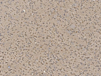 IHC staining of FFPE mouse brain tissue with Eukaryotic translation initiation factor 5 antibody. HIER: boil tissue sections in pH8 EDTA for 20 min and allow to cool before testing.