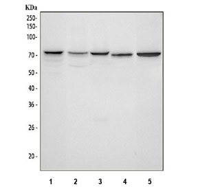 Western blot testing of 1) human HepG2, 2) human 293T, 3) human Jurkat, 4) rat brain and 5) mouse brain lysate with PPP2R5D antibody. Predicted molecular weight ~58 kDa, ~66 kDa and ~70 kDa (multiple isoforms).