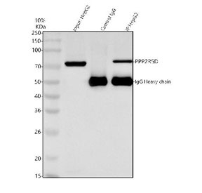 Immunoprecipitation of PPP2R5D protein from 500ug of human HepG2 whole cell lysate with 2ug of PPP2R5D antibody.