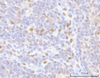 IHC staining of FFPE human tonsil tissue with HOXD10 antibody. HIER: boil tissue sections in pH8 EDTA for 20 min and allow to cool before testing.