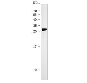 Western blot testing of human HCCT cell lysate with Mannose-binding protein C antibody. Predicted molecular weight ~26 kDa.