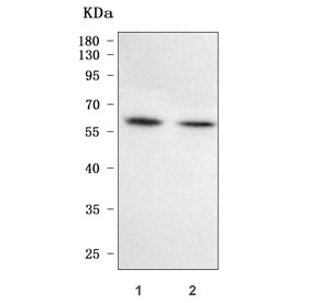 Western blot testing of human 1) HCCT and 2) HCCP cell lysate with PFKFB1 antibody. Predicted molecular weight ~55 kDa and ~47 kDa (two isoforms).