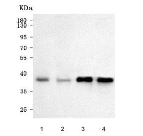 Western blot testing of human 1) K562, 2) placenta, 3) Daudi and 4) Raji cell lysate with Serpin B9 antibody. Predicted molecular weight ~42 kDa.