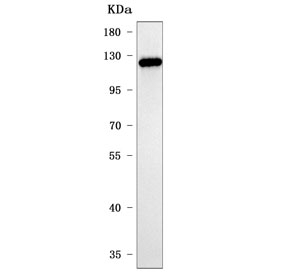 Western blot testing of human A431 cell lysate with PPP2R3A antibody. Predicted molecular weight ~130 kDa and ~72 kDa as well as possibly ~48 kDa (multiple isoforms).