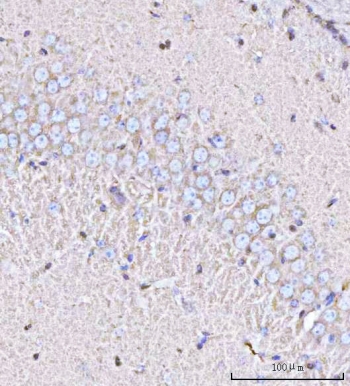 IHC staining of FFPE mouse brain tissue with Calcineurin B antibody. HIER: boil tissue sections in pH8 EDTA for 20 min and allow to cool before testing.