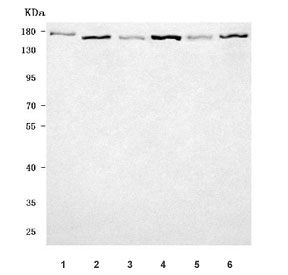Western blot testing of 1) human HeLa, 2) human 293T, 3) rat brain, 4) rat C6, 5) mouse brain and 6) mouse NIH 3T3 cell lysate with ROCK1 antibody. Predicted molecular weight ~158 kDa.