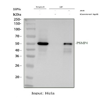 Immunoprecipitation of PSMD4 protein from 500ug of human HeLa whole cell lysate with 2ug of PSMD4 antibody.