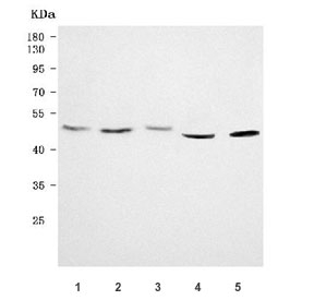 Western blot testing of 1) human HeLa, 2) human K562, 3) human A431, 4) human HepG2 and 5) rat PC-12 cell lysate with RXR alpha antibody. Predicted molecular weight: ~51 kDa but routinely observed at 54~60 kDa.