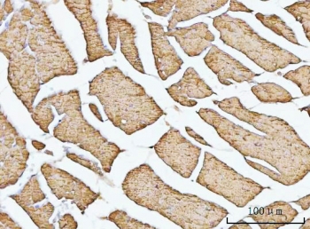 IHC staining of FFPE mouse heart tissue with VDAC1 antibody. HIER: boil tissue sections in pH8 EDTA for 20 min and allow to cool before testing.