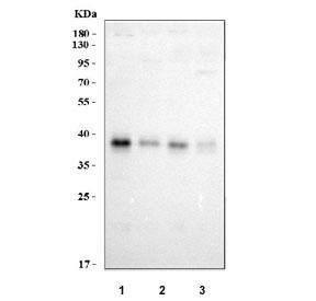 Western blot testing of human 1) 293T, 2) HeLa, 3) MCF7 and 4) A549 cell lysate with XPA antibody. Predicted molecular weight ~31 kDa, commonly observed at 31-40 kDa.