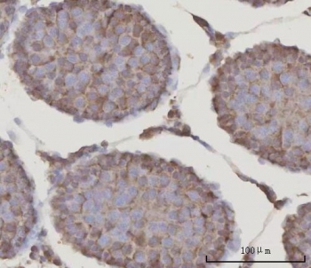 IHC staining of FFPE rat testis tissue with PRDM2 antibody. HIER: boil tissue sections in pH8 EDTA for 20 min and allow to cool before testing.