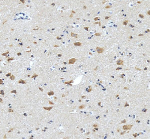 Liprin alpha 2 Antibody Human Brain IHC. Immunohistochemistry analysis of FFPE human brain tissue using Liprin alpha 2 Antibody / Synaptic Scaffold Protein Antibody. Heat mediated antigen retrieval was performed using pH 8 EDTA buffer, and the tissue section was incubated with the primary antibody at 2 ug/ml overnight at 4Â°C. HRP-conjugated secondary antibody and DAB substrate were used for detection. Cytoplasmic staining is observed in neuronal cells, supporting the use of Liprin alpha 2 Antibody / Synaptic Scaffold Protein Antibody for studying synaptic scaffold protein expression, neuronal signaling and presynaptic organization pathways.
