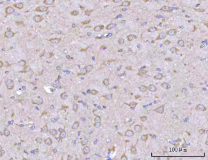 Liprin alpha 2 Antibody Rat Brain IHC. Immunohistochemistry analysis of FFPE rat brain tissue using Liprin alpha 2 Antibody / Synaptic Scaffold Protein Antibody. Heat induced antigen retrieval was performed by boiling tissue sections in pH 8 EDTA buffer for 20 minutes prior to staining. Cytoplasmic and neuronal staining is observed within brain tissue, consistent with the role of Liprin alpha 2 in synaptic organization and neuronal signaling. These results support the use of Liprin alpha 2 Antibody / Synaptic Scaffold Protein Antibody for studying synaptic scaffold proteins, presynaptic regulation and nervous system function.