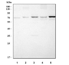 Western blot testing of 1) human HepG2, 2) rat liver, 3) rat kidney, 4) mouse liver and 5) mouse kidney tissue lysate with PAPSS2 antibody. Predicted molecular weight ~70 kDa.