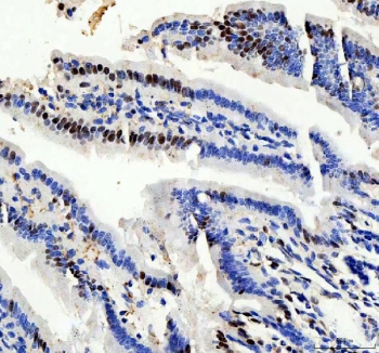 IHC staining of FFPE mouse colon tissue with PRPF4 antibody. HIER: boil tissue sections in pH8 EDTA for 20 min and allow to cool before testing.