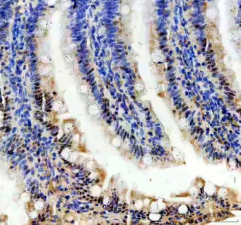 IHC staining of FFPE rat colon tissue with PRPF4 antibody. HIER: boil tissue sections in pH8 EDTA for 20 min and allow to cool before testing.