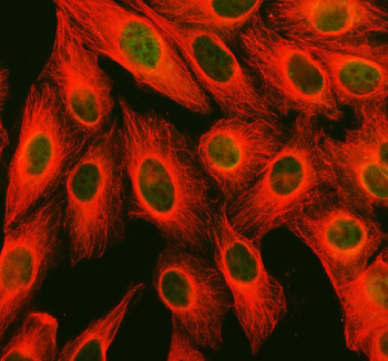 Immunofluorescent staining of FFPE human U-2 OS cells with PPM1F antibody (green) and Alpha Tubulin mAb (red). HIER: steam section in pH6 citrate buffer for 20 min.
