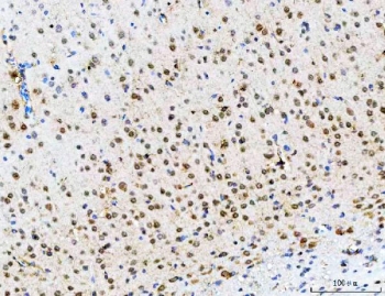 IHC staining of FFPE rat brain tissue with PSMD14 antibody. HIER: boil tissue sections in pH8 EDTA for 20 min and allow to cool before testing.