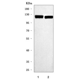 Western blot testing of 1) rat heart and 2) mouse heart tissue lysate with Nebulette antibody. Predicted molecular weight ~116 kDa.