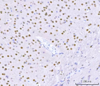 IHC staining of FFPE mouse brain tissue with SAM68 antibody. HIER: boil tissue sections in pH8 EDTA for 20 min and allow to cool before testing.