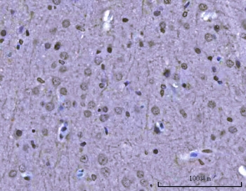 IHC staining of FFPE rat brain tissue with SAM68 antibody. HIER: boil tissue sections in pH8 EDTA for 20 min and allow to cool before testing.